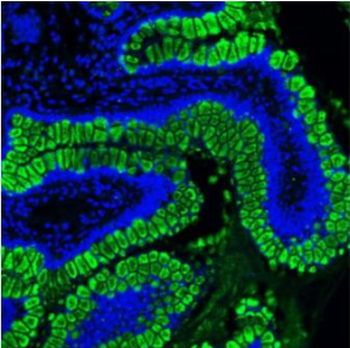 MUC2 Rabbit Polyclonal Antibody