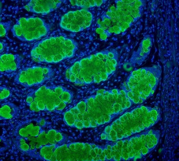 MUC2 Rabbit Polyclonal Antibody