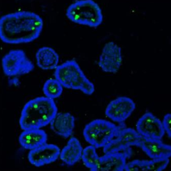 MUC2 Rabbit Polyclonal Antibody