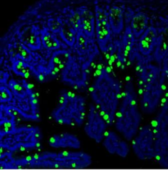 MUC2 Rabbit Polyclonal Antibody