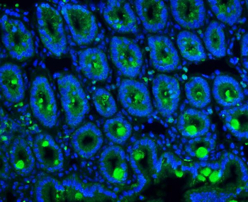 MUC2 Rabbit Polyclonal Antibody