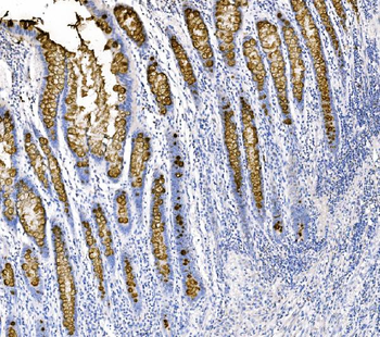 MUC2 Rabbit Polyclonal Antibody