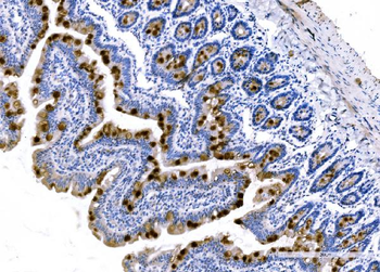 MUC2 Rabbit Polyclonal Antibody