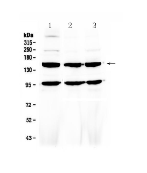VEGF Receptor 3/FLT4 Rabbit Polyclonal Antibody