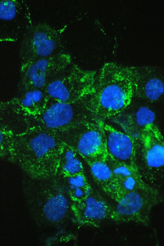 VEGF Receptor 3/FLT4 Rabbit Polyclonal Antibody