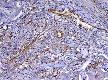VEGF Receptor 3/FLT4 Rabbit Polyclonal Antibody