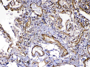 VEGF Receptor 3/FLT4 Rabbit Polyclonal Antibody