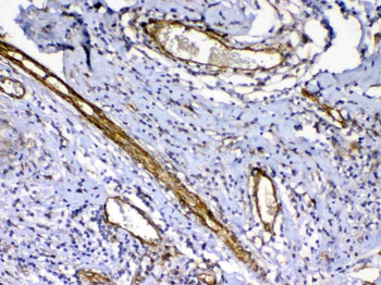 VEGF Receptor 3/FLT4 Rabbit Polyclonal Antibody