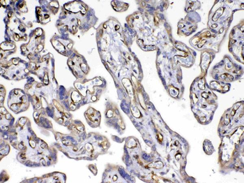 VEGF Receptor 3/FLT4 Rabbit Polyclonal Antibody