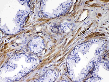 VEGF Receptor 3/FLT4 Rabbit Polyclonal Antibody