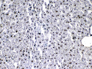 VEGF Receptor 3/FLT4 Rabbit Polyclonal Antibody