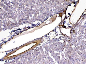 VEGF Receptor 3/FLT4 Rabbit Polyclonal Antibody