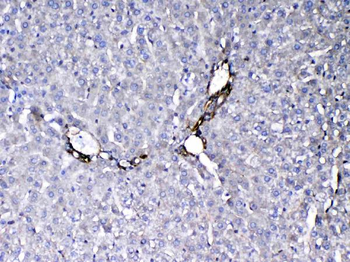 VEGF Receptor 3/FLT4 Rabbit Polyclonal Antibody