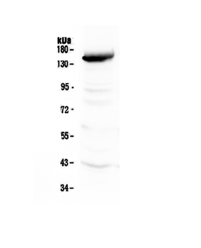 VEGF Receptor 3/FLT4 Rabbit Polyclonal Antibody