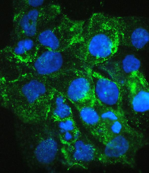 VEGF Receptor 3/FLT4 Rabbit Polyclonal Antibody