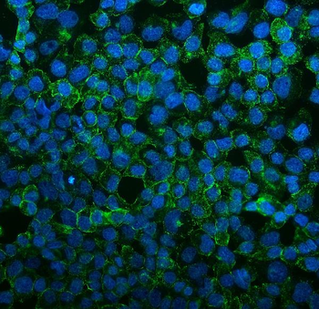 VEGF Receptor 3/FLT4 Rabbit Polyclonal Antibody