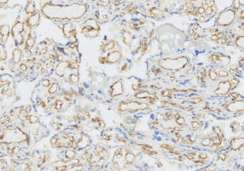 VEGF Receptor 3/FLT4 Rabbit Polyclonal Antibody