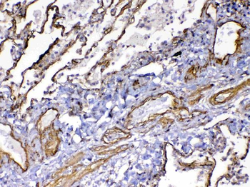 VEGF Receptor 3/FLT4 Rabbit Polyclonal Antibody