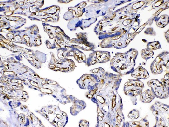 VEGF Receptor 3/FLT4 Rabbit Polyclonal Antibody