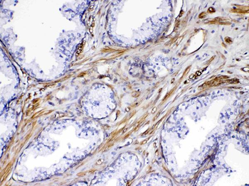 VEGF Receptor 3/FLT4 Rabbit Polyclonal Antibody