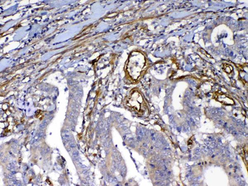 VEGF Receptor 3/FLT4 Rabbit Polyclonal Antibody