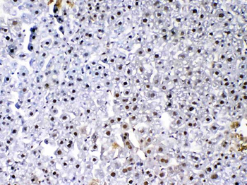 VEGF Receptor 3/FLT4 Rabbit Polyclonal Antibody