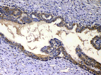 IGFBP2 Rabbit Polyclonal Antibody