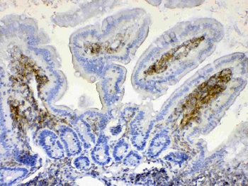 Lyn Rabbit Polyclonal Antibody