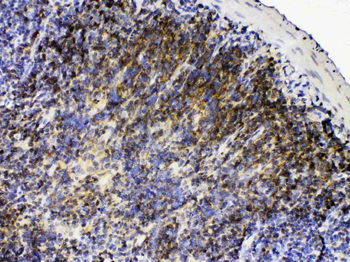 Lyn Rabbit Polyclonal Antibody