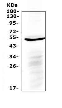 IL6R Rabbit Polyclonal Antibody