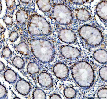 GALT Rabbit Polyclonal Antibody