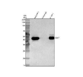 GALT Rabbit Polyclonal Antibody