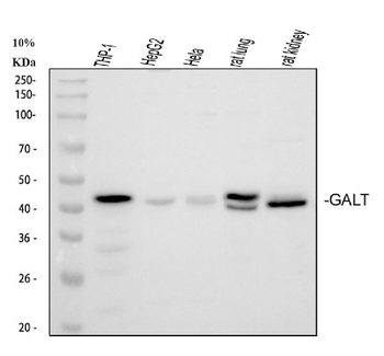 GALT Rabbit Polyclonal Antibody