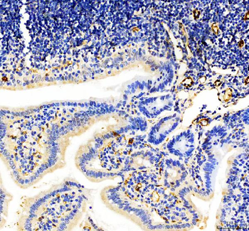 CD31/Pecam1 Rabbit Polyclonal Antibody