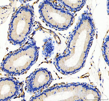 CD31/Pecam1 Rabbit Polyclonal Antibody