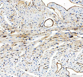 CD31/Pecam1 Rabbit Polyclonal Antibody