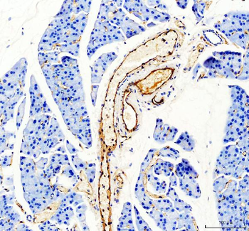CD31/Pecam1 Rabbit Polyclonal Antibody