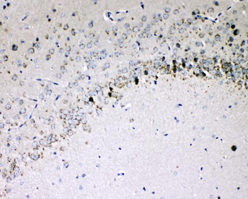 IL-16/Il16/IL Rabbit Polyclonal Antibody