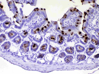 TFF3 Rabbit Polyclonal Antibody