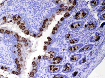 TFF3 Rabbit Polyclonal Antibody