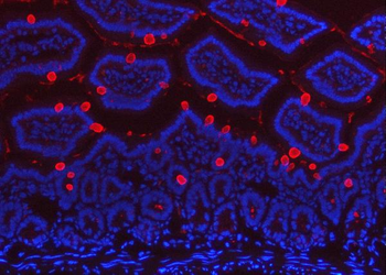 TFF3 Rabbit Polyclonal Antibody