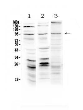 Semaphorin 3A/SEMA3A Rabbit Polyclonal Antibody