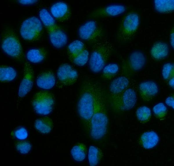 Superoxide Dismutase 3/SOD3 Rabbit Polyclonal Antibody