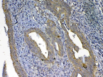 UGT1A1 Rabbit Polyclonal Antibody