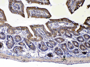 UGT1A1 Rabbit Polyclonal Antibody
