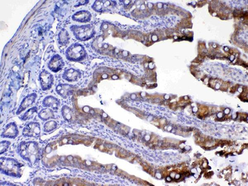 UGT1A1 Rabbit Polyclonal Antibody