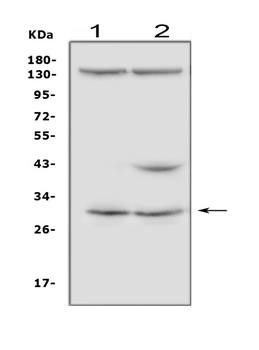 IGFBP5 Rabbit Polyclonal Antibody