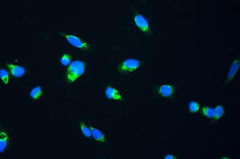 FH Rabbit Polyclonal Antibody