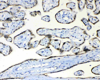 FH Rabbit Polyclonal Antibody