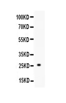 TREM1 Rabbit Polyclonal Antibody